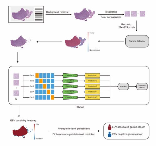 人工智能助力胃癌分子分型 中腫蔡木炎團隊取得研究新進展